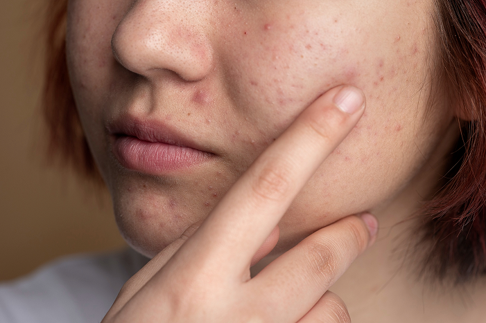 Formulated for Sensitive and Delicate Skin
